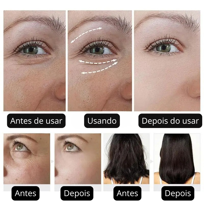 Óleo de Rosa Mosqueta Puro – Hidratação, Renovação e Brilho Natural